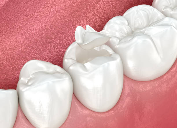 Our Range of Dental Services in Moorestown Lenola, NJ